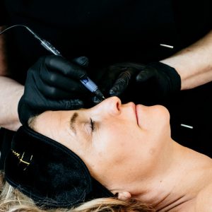 Epilering med Diatermi max 25 min